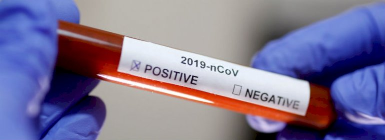 Behovet for testudstyr er blevet et centralt emne i den danske bekæmpelse af coronasmitten.<br />Foto: Dado Ruvic, Reuters